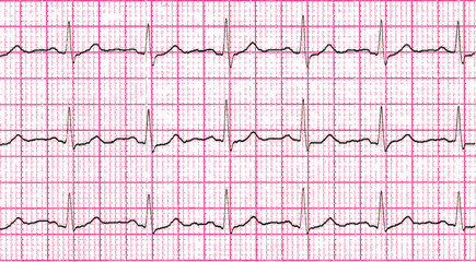 Cardiogram. Fragment of research result by CU