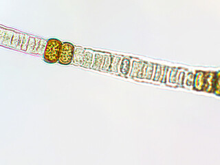 Nodularia sp. toxic algae under microscopic view, nitrogen-fixing cyanobacteria, cyanotoxin,...