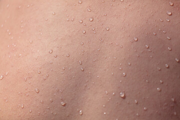 Water drops on human skin as an abstract background.