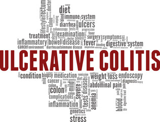 Fototapeta na wymiar Ulcerative Colitis vector illustration word cloud isolated on a white background.
