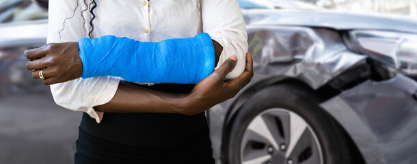Fototapeta premium Broken Arm After Car Accident. Injury And Insurance