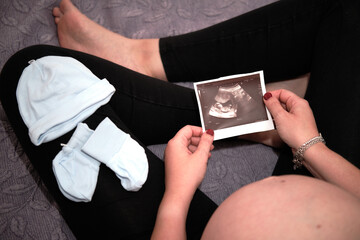 Pregnant woman looking at an ultrasound scan of her baby