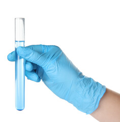 Doctor holding test tube with liquid on white background, closeup