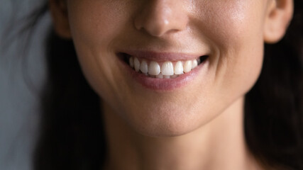 Cropped shot of mouth and toothy smile close up. Happy woman with healthy white perfect teeth...