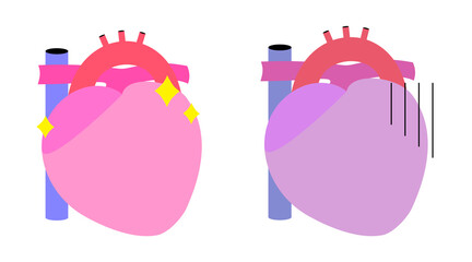 心臓のシンプルなイラスト。健康なものと不健康なものの二つ。