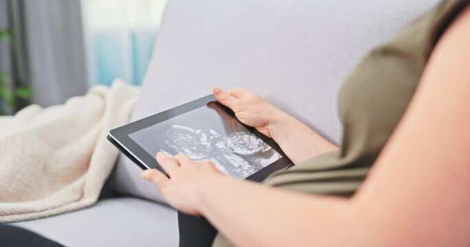Pregnant woman sits on the couch in the living room and holds her belly, in hand is a tablet with an ultrasound of the baby in the womb, a picture of the fetus, the mother-to-be is happy