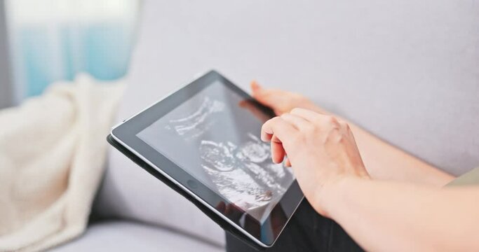 Pregnant girl sits on the couch in the living room and holds her belly, in hand is a tablet with an ultrasound of the baby in the womb, a picture of the fetus, the mother-to-be is happy