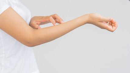 A young woman with itching on her arm and hand is scratching. white background medical concept