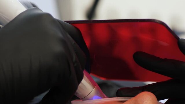 Patient treats the teeth with a polymerization lamp to harden the filling on the tooth. Gloved hands hold a red protective glass close up