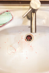 White wash basin, floss residues, blood stains from flosser damage to the gums.