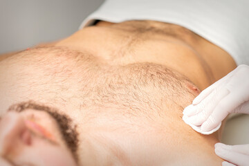 Young caucasian man receiving hair removal from his chest in a beauty salon, depilation men's torso