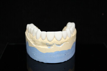 Dental shade guide for dentist and technician