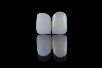 Close up artificial lithium-disilicate dental crowns of central incisors unpainted and painted.
