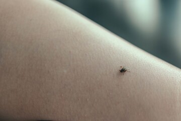 common housefly on human skin.