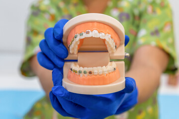 Doctor holding professional denture teeth with dental braces and transparent brackets