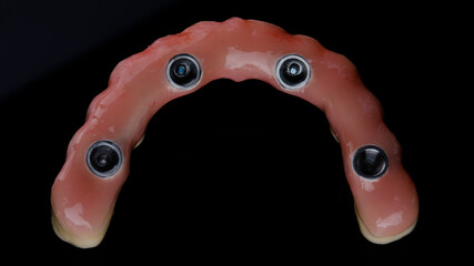 dental prosthesis made of ceramic and titanium of the upper jaw top view on a black background