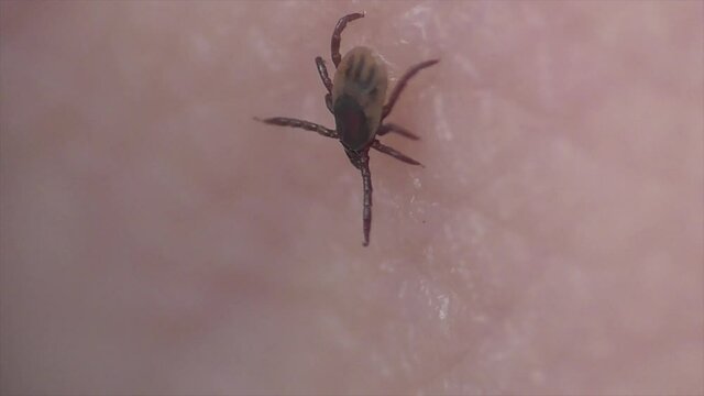 Zecke l&auml;uft &uuml;ber Haut