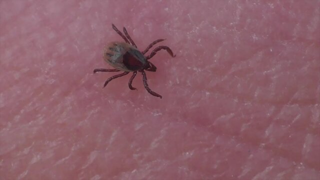 Zecke l&auml;uft &uuml;ber Haut