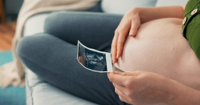 Shot from above with view of pregnant girl sitting comfortably on sofa, wearing sweatpants and short top, woman touches large belly, puts hand on it, strokes it, looks at usg photo, ultrasound