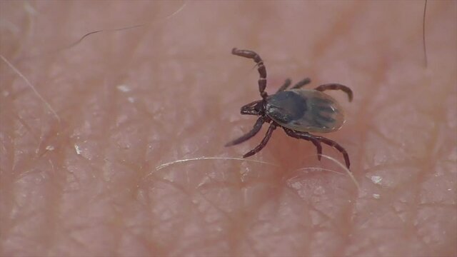 Zecke l&auml;uft &uuml;ber Haut