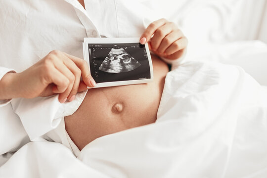 Pregnant woman with sonogram image