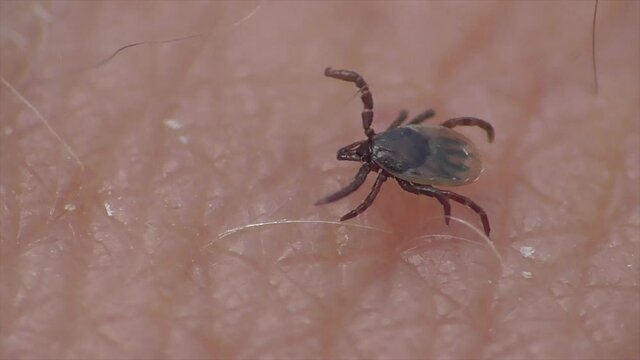 Zecke l&auml;uft &uuml;ber Haut