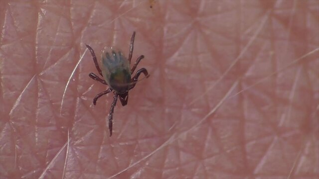 Zecke l&auml;uft &uuml;ber Haut
