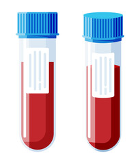 Test Tube with Blood Sample Isolated.