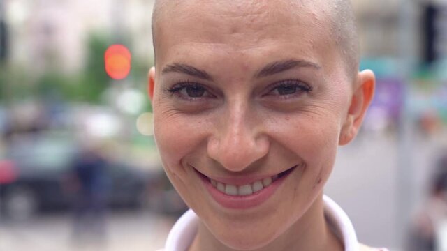 Young smiling bald woman looking at camera standing on the street 
