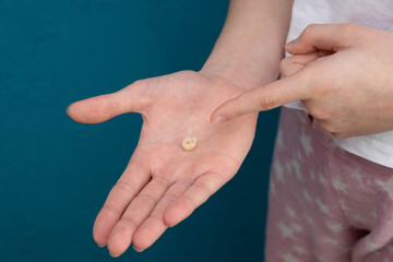 teenage girl showing her fallen milk tooth