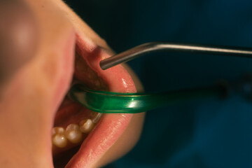 Closeup clean dental examination on a woman's teeth in a dental office