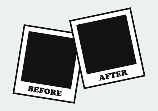 before after icon screen, icon vector