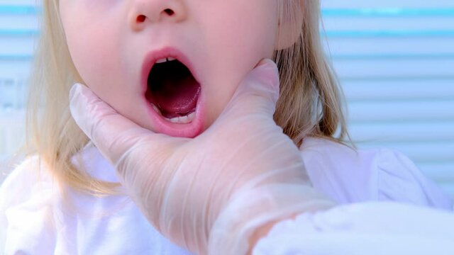 closeup female hands, dentist, doctor examines oral cavity of small patient, blonde girl 2 years old, molars grow, kid with open mouth, close up of child’s mouth, white teeth
