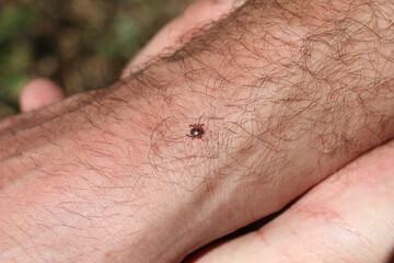 Dangerous for health a blood-sucking tick on a human hand on a bright sunny day.