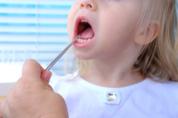 closeup female hands, dentist, doctor examines oral cavity of small patient, blonde girl 2 years...