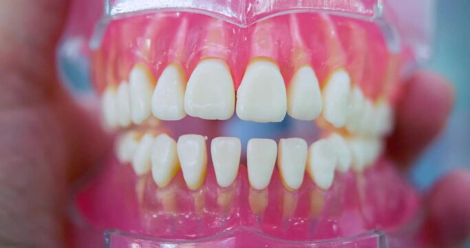 Jaw model of ceramic teeth is holding medical worker close-up