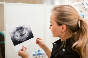 blonde white girl doctor dentist looking at x-ray of the jaw