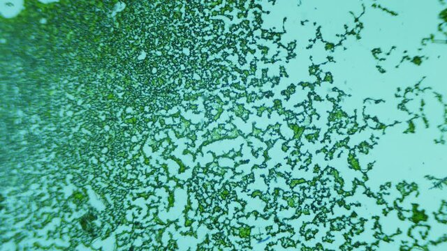 Dried unicellular algae on a slide under a microscope. Research of biochemical processes of the world ocean. Building a forecast of planetary climate change