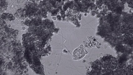 Black and white shot of vorticella and amoebae. Microscopic organisms hunt.