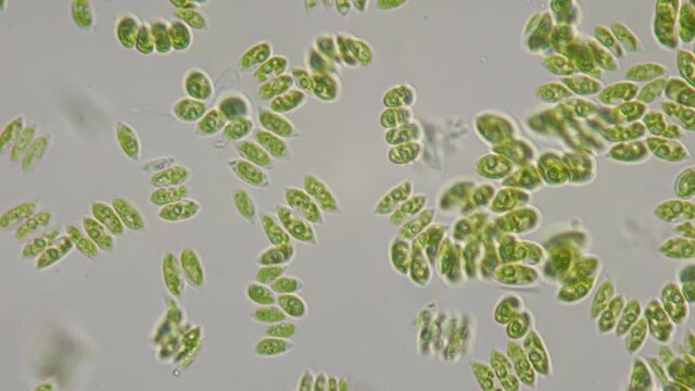 Small groups of unicellular algae float in liquid under a microscope. Research in a biological laboratory. 1000x magnification.
