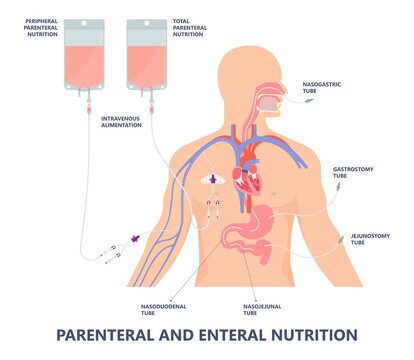 total parenteral nutrition label