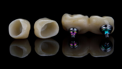 top quality ceramic inlays and crowns on black glass with creative reflection