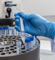 Loading a sample to centrifuge machine in the medical laboratory
