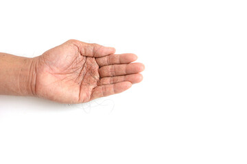 Hair loss, hair loss every day, serious problems and hair loss on a white background.