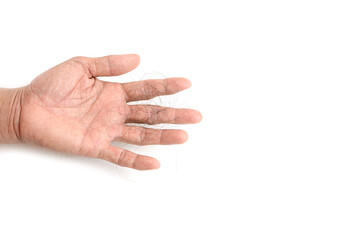 Hair loss, hair loss every day, serious problems and hair loss on a white background.