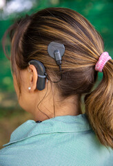 Woman head with cochleral implant hearing aid.