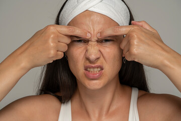 a young frowning woman squeezing a wrinkle on her forehead