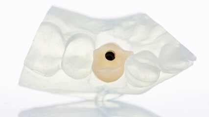 temporary dental crown composition on a special polymer model on a white background