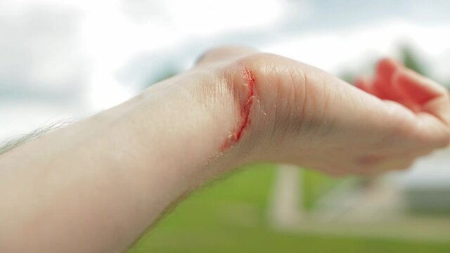 Wound cut on a man's hand, close-up. Blood on the wrist, skin