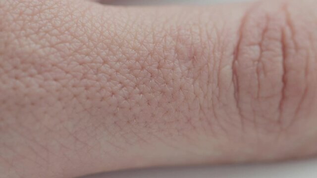 pores on the skin of a finger in a person, close-up. Skin hydration and nutrition concept, dermatology, macro